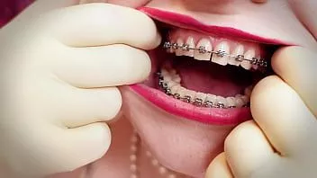 play Video Asmr: milf poartă mănuși medicale cu două straturi și arată aparatul dentar. Sună fetiș video 4k. arya mai mare